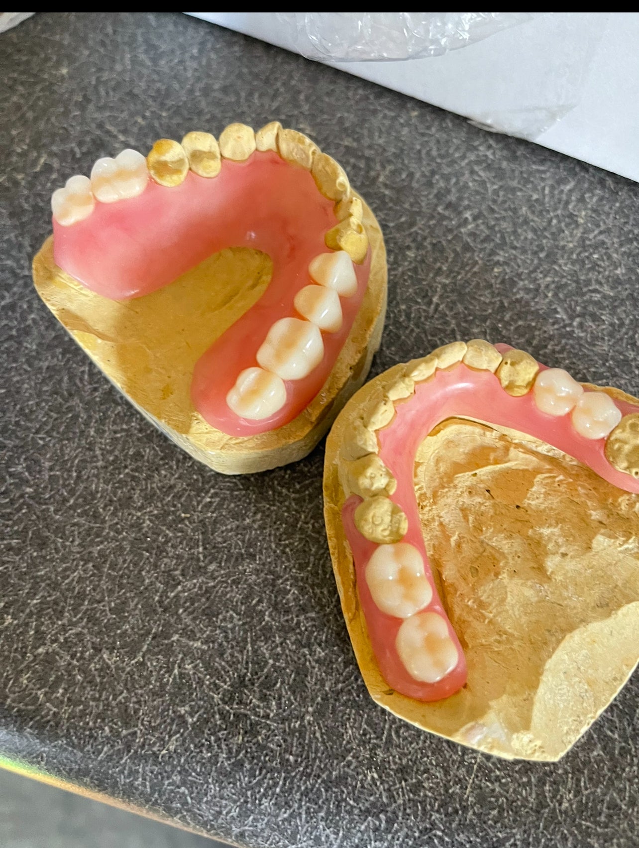 Jos’ Dentures: Smile dentures Kit for just one arch.