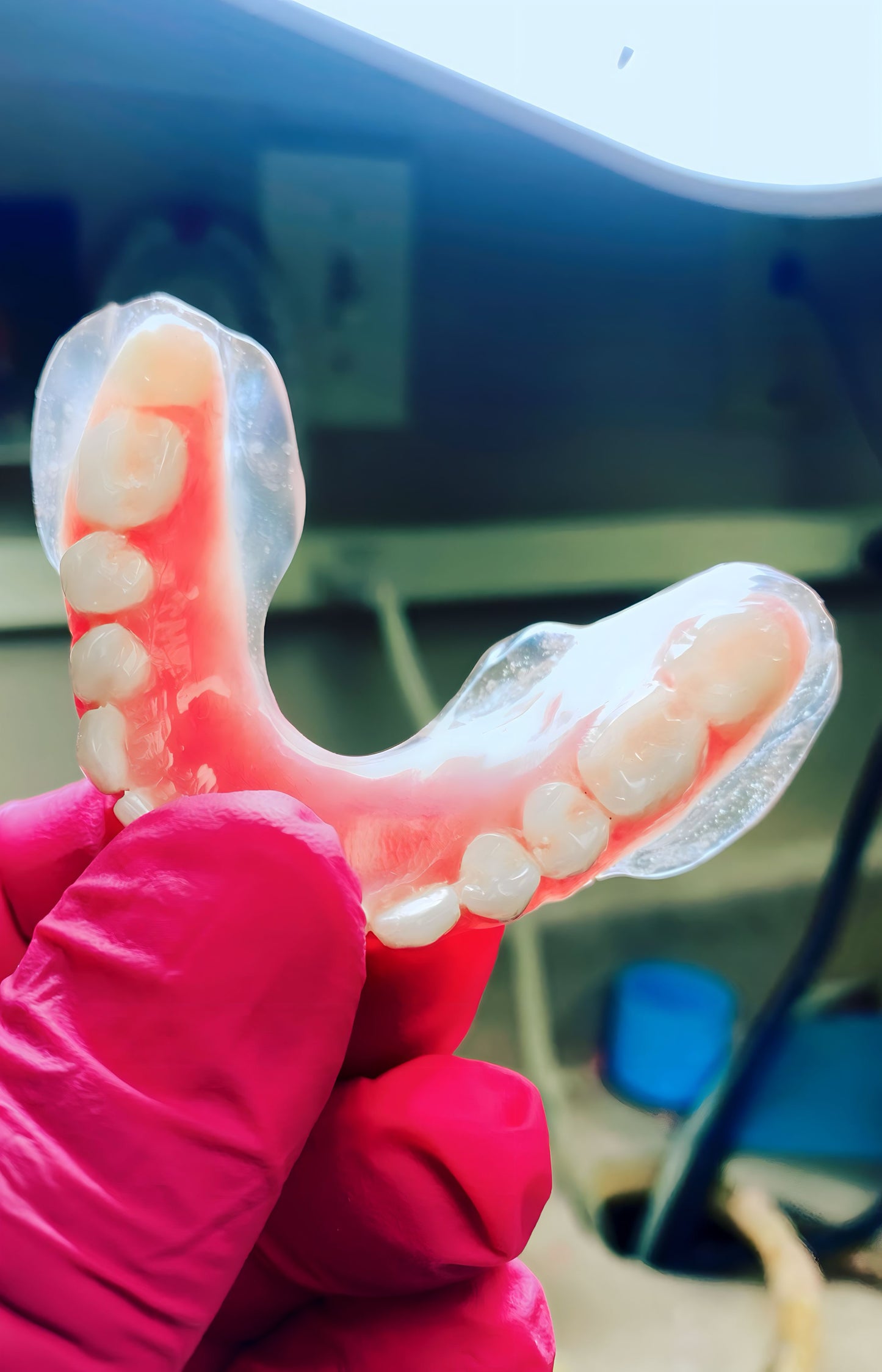 Jos’ Dentures: Smile dentures Kit for just one arch.