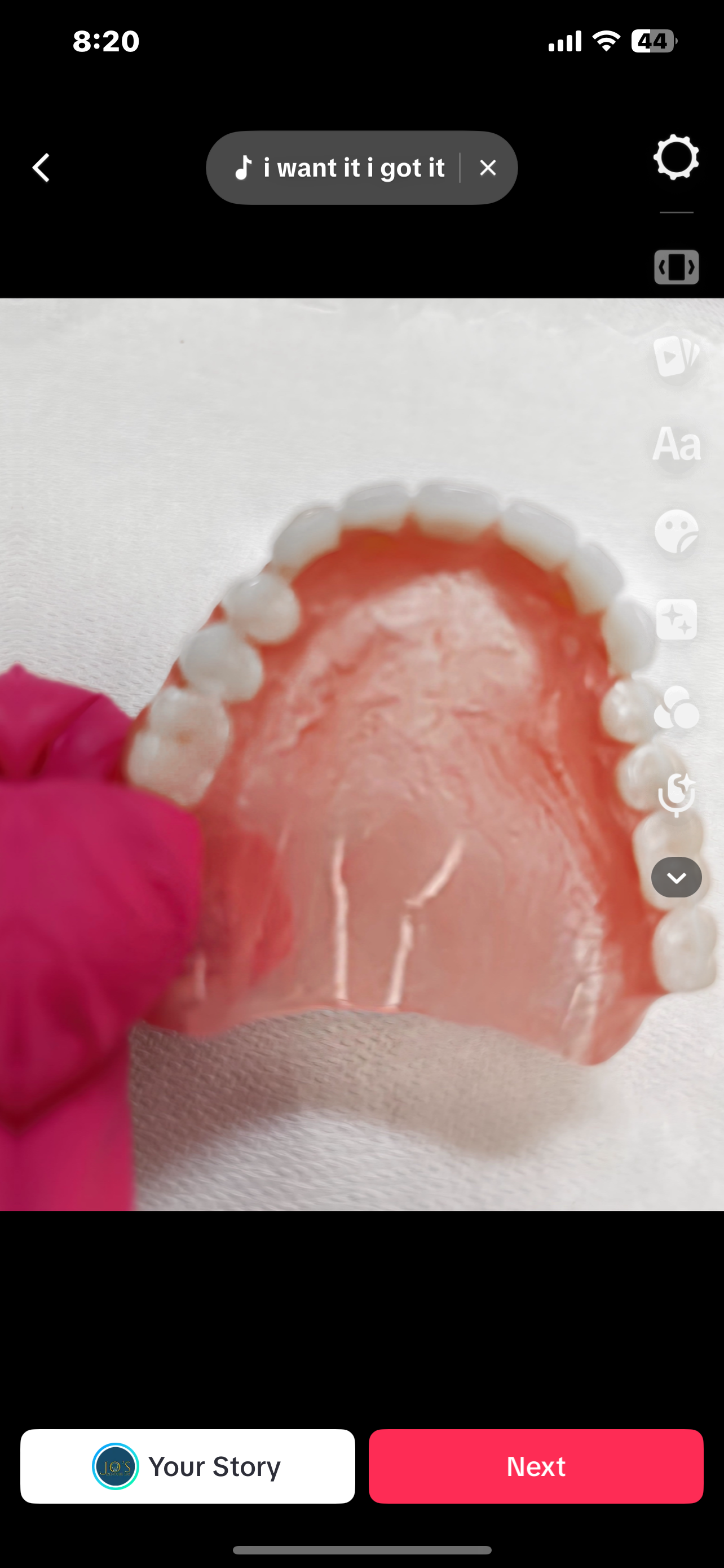 Upper and Lower Dentures” Custom Full Denture Kit