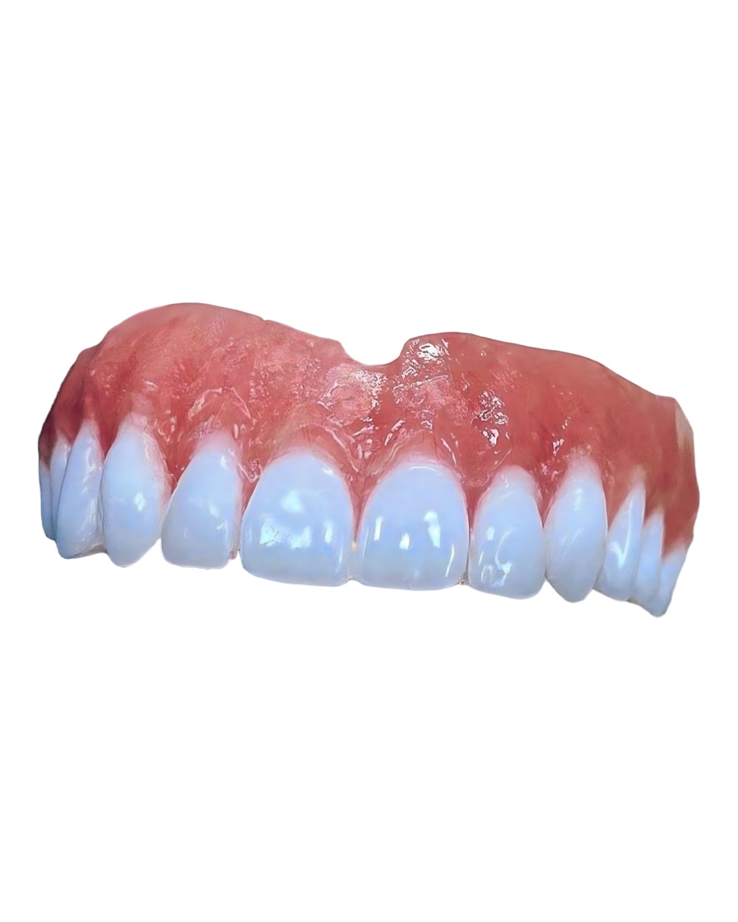 “Upper  Premium Denture Kit – Ultimate Comfort and Luxury Fit!”