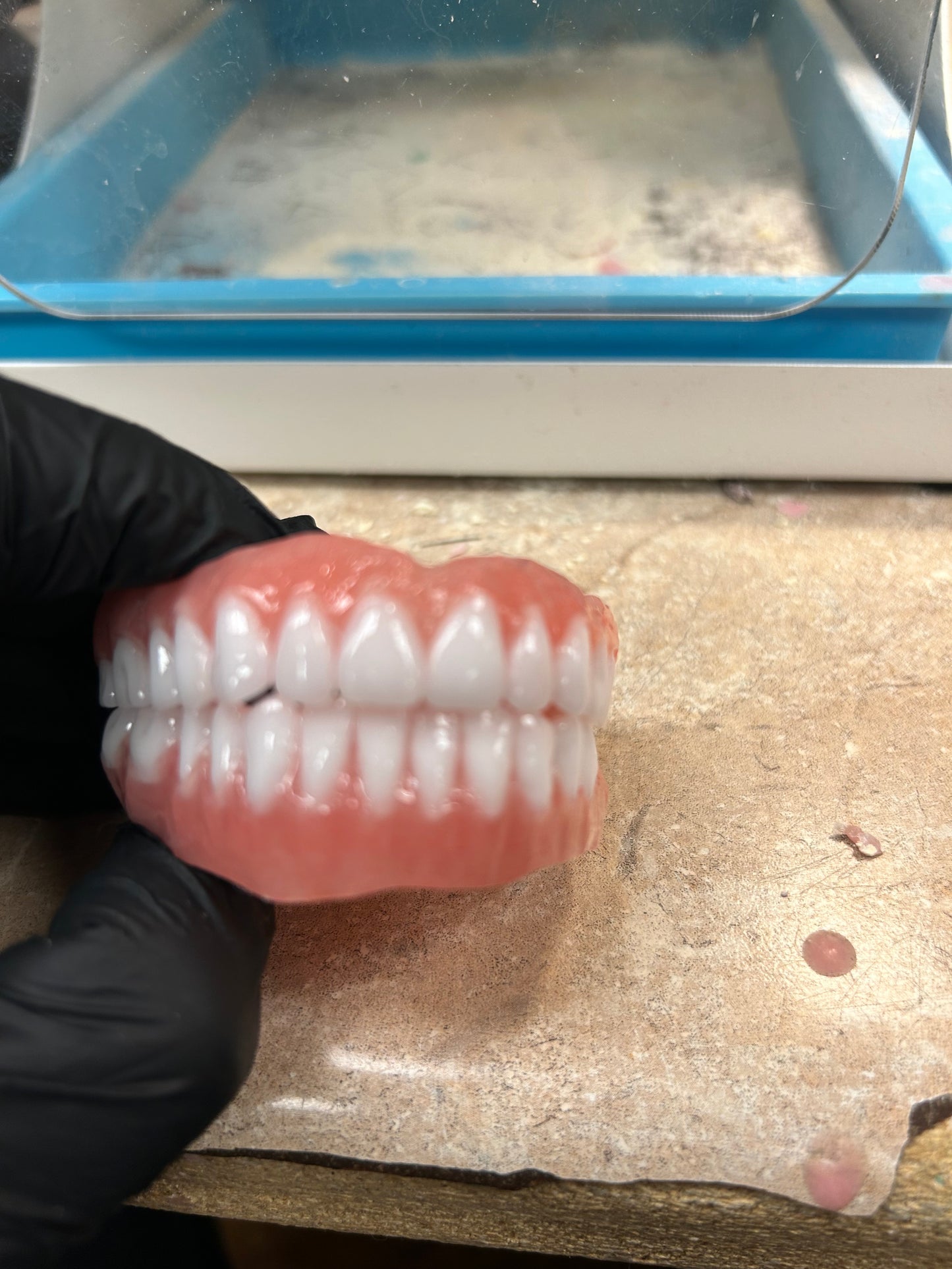 Custom Upper Denture Kit