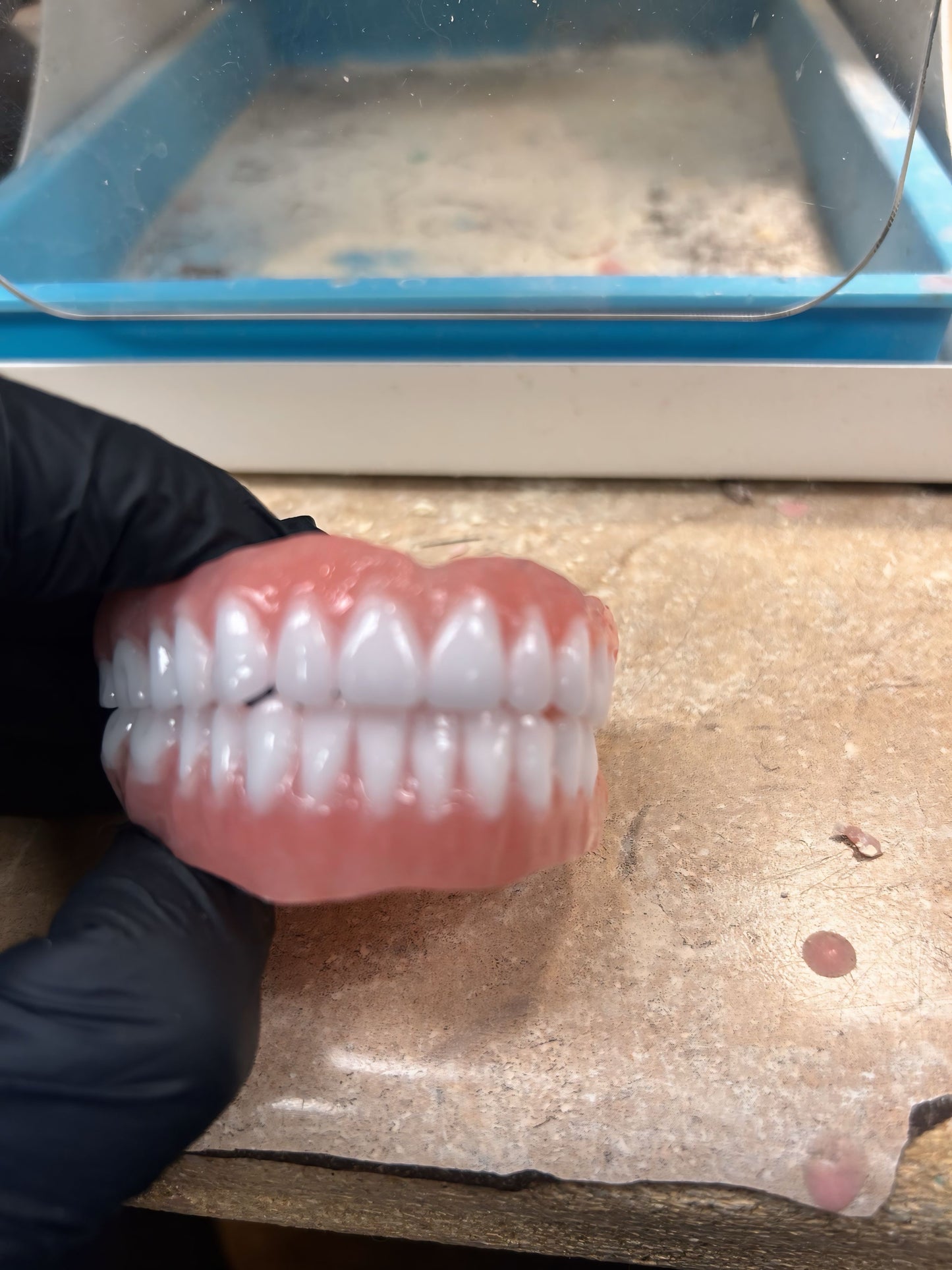 Custom Upper Denture Kit