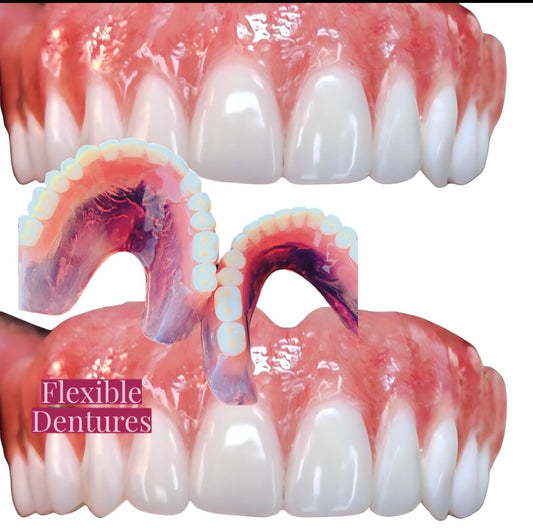 Upper and Lower Dentures” Custom Full Denture Kit
