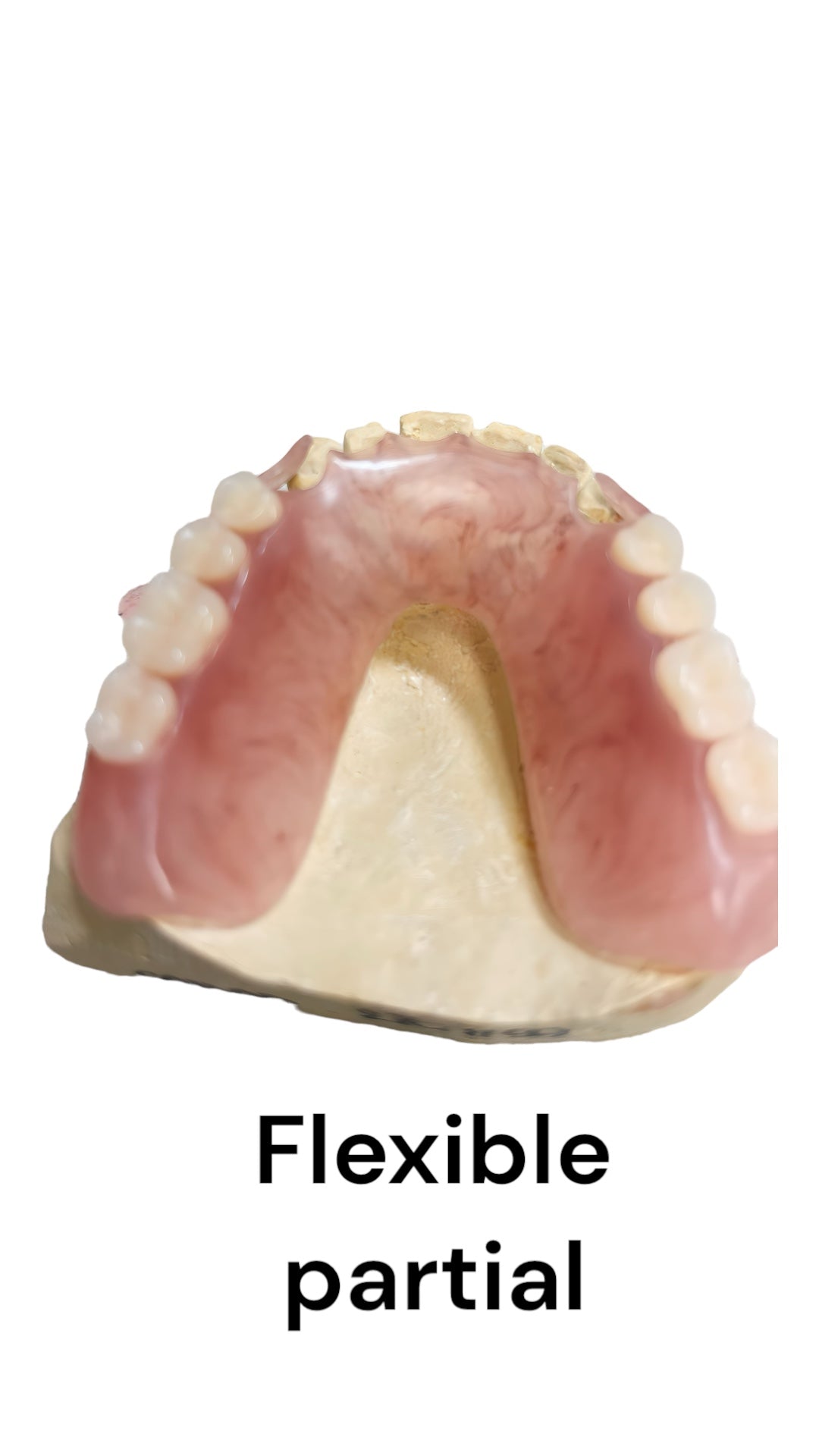 Premium Upper & Lower Flexible denture kit Partial Dentures: Realistic 3D Teeth for a Natural Smile
