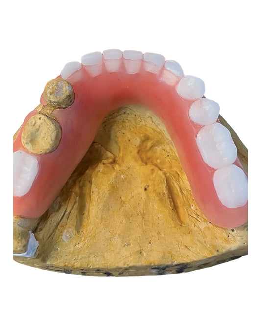“FlexEase Smiles:   Denture Kit Partial Upper And Lower partial. This
