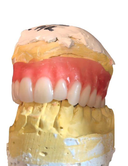 Superior Quality Upper and lower Denture Kit Crafted with Phonares II Teeth for a Natural Smile”