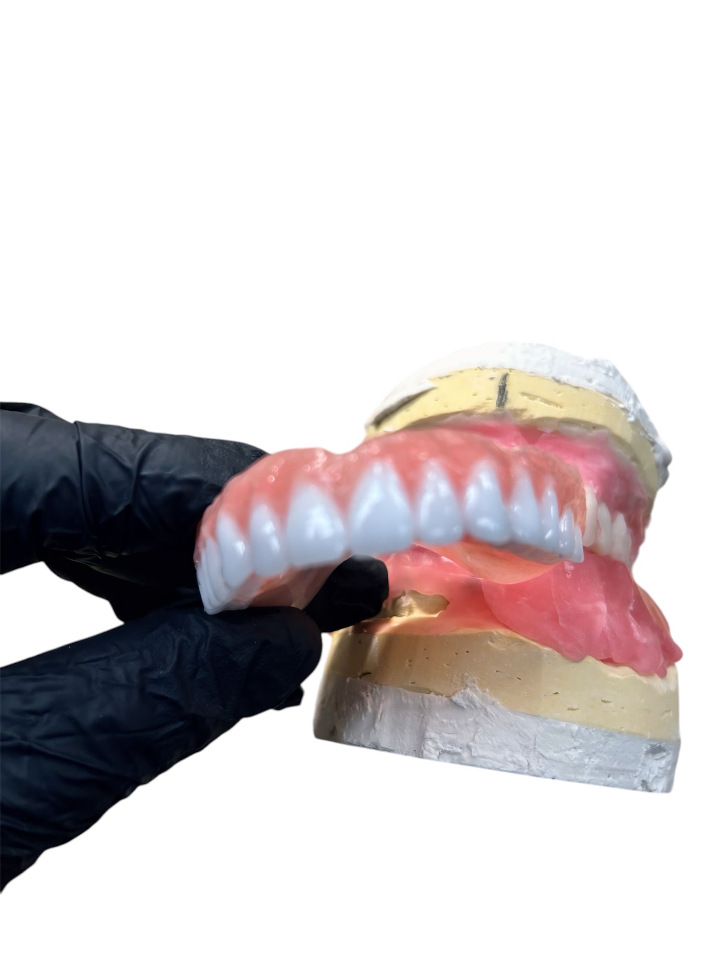 Custom Upper Denture Kit