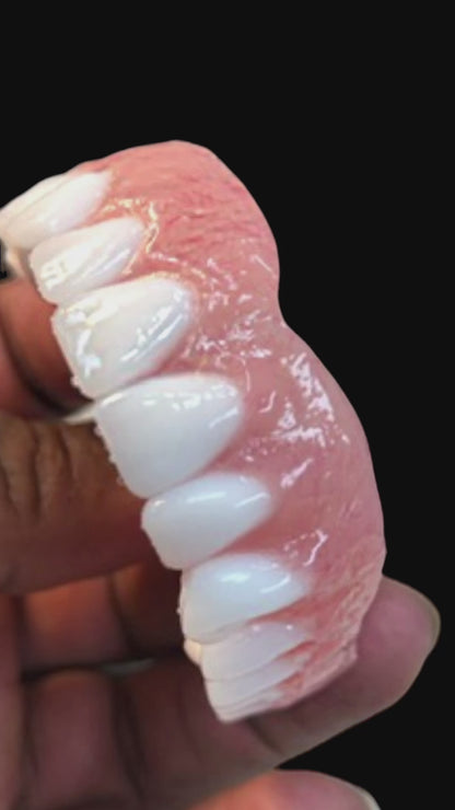 Custom Upper Denture Kit